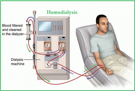 Hemodialysis and Vaccination Research: